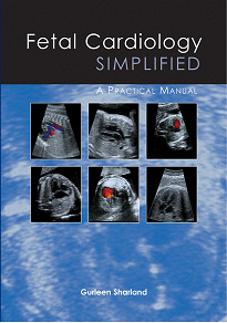 Omslagsbild för Fetal Cardiology Simplified  